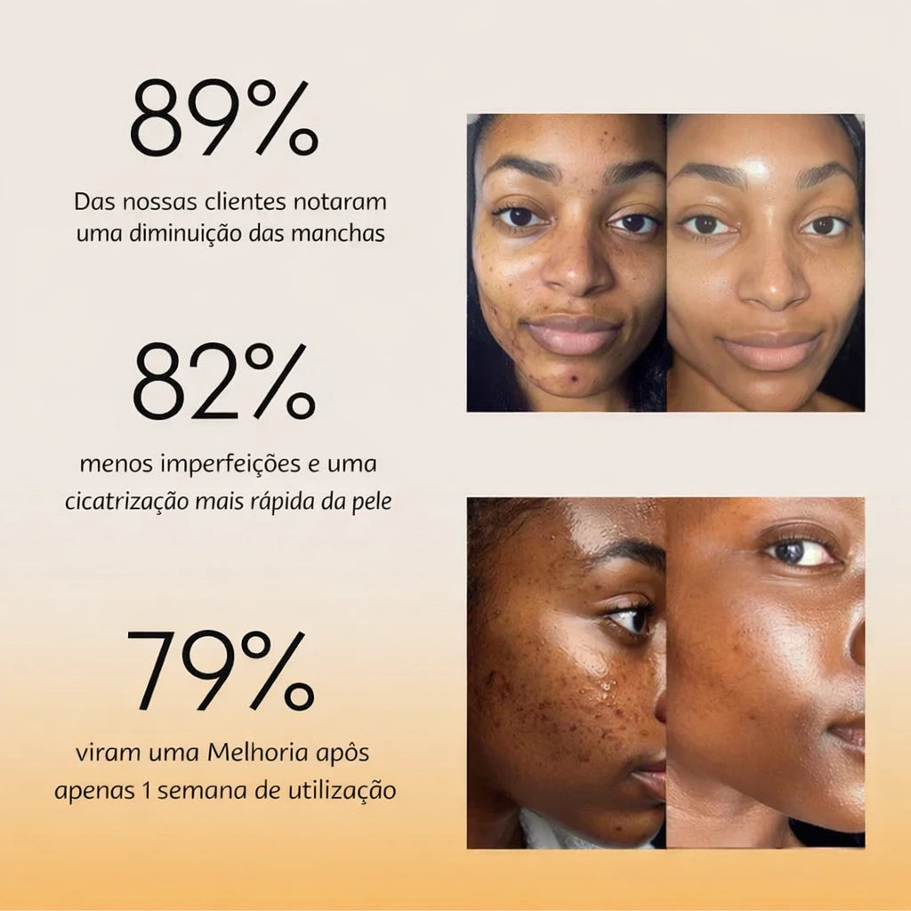 Sérum Anti-Imperfeições Upsell