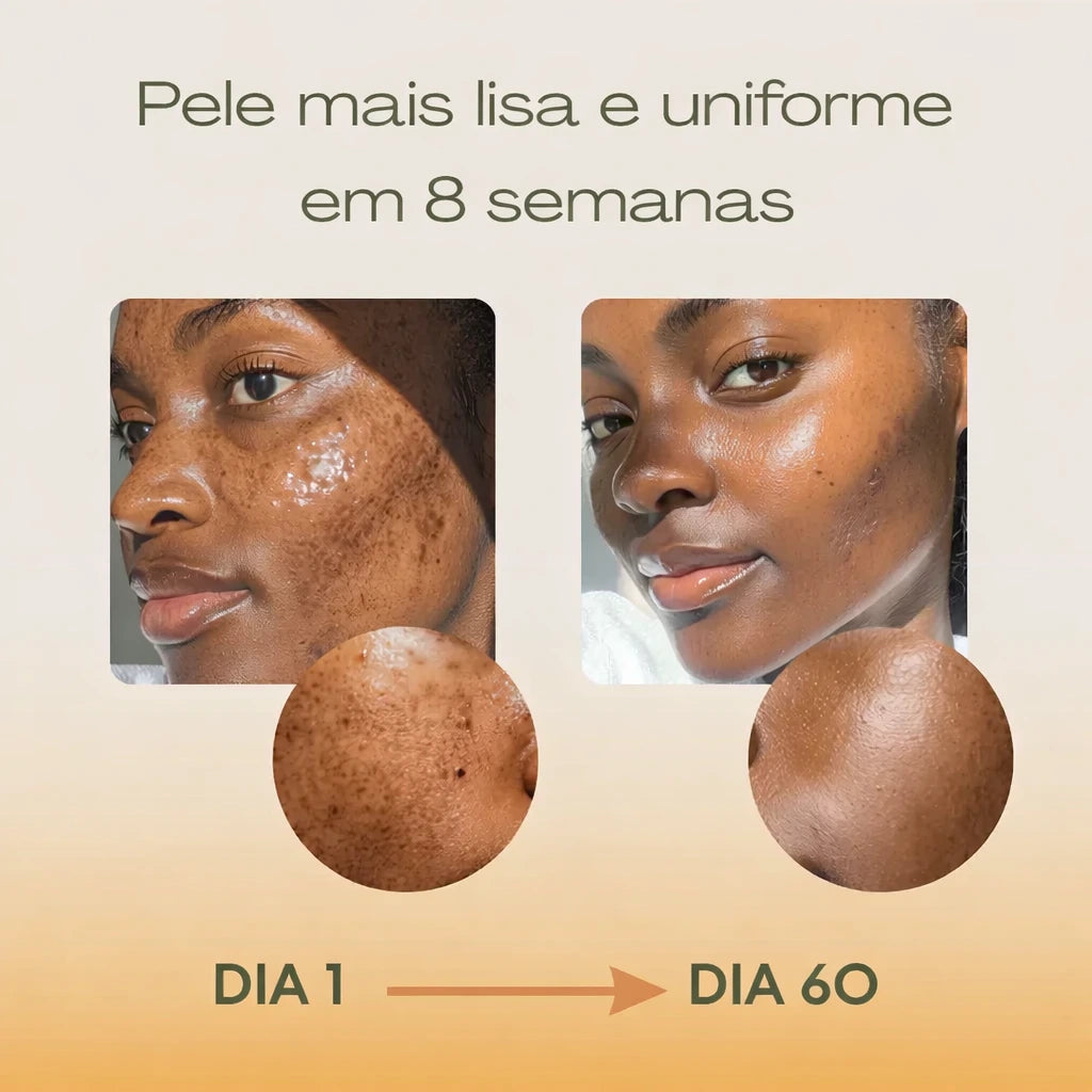 Sérum Anti-Imperfeições Upsell